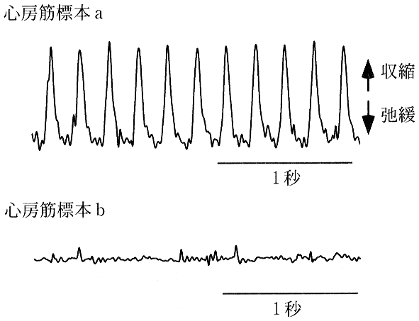 図1—2　摘出した心房筋標本 a および b の収縮弛緩反応