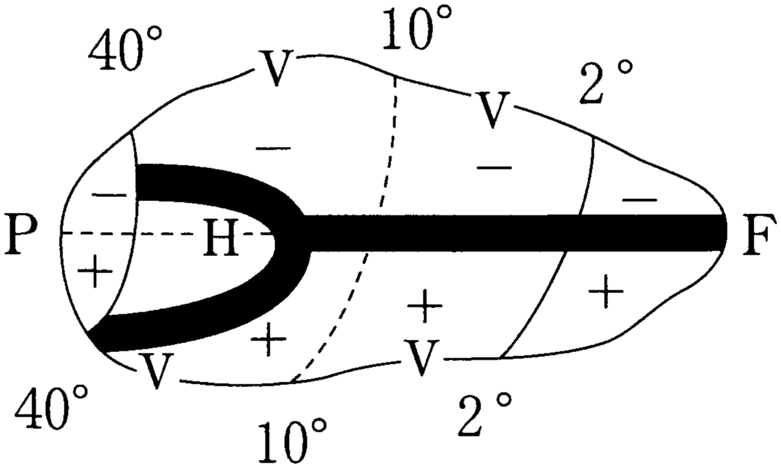図3—5　ある視覚対象に対応する大脳右半球の視覚野の領域
